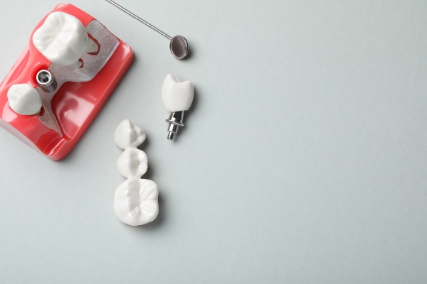 Dental Bridge Guide: How It Works, Pros/Cons, And How Long It Lasts