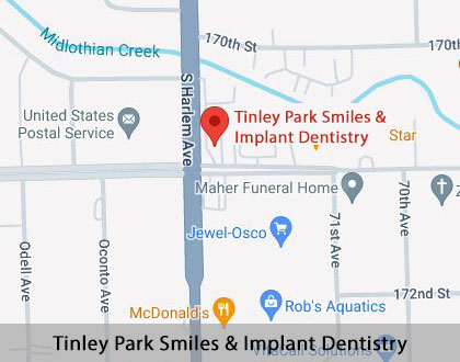 Map image for Emergency Dentist vs. Emergency Room in Tinley Park, IL