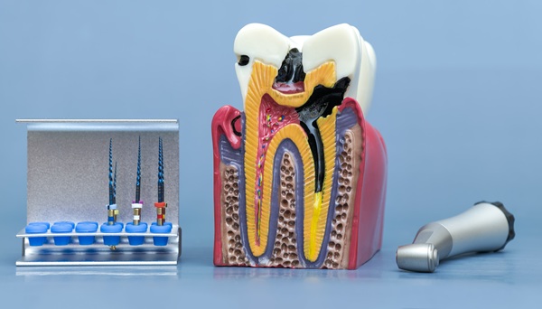 Common Myths About Root Canals, Debunked By Dentists